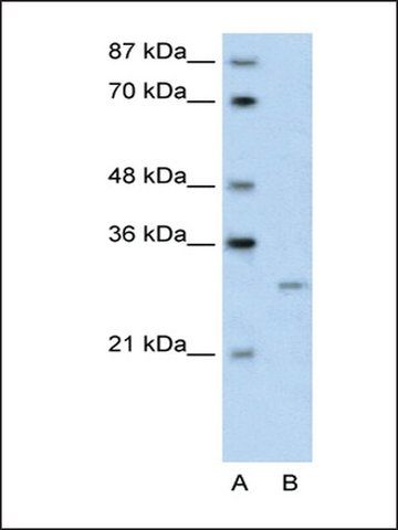 Anti-CREG1 antibody produced in rabbit
