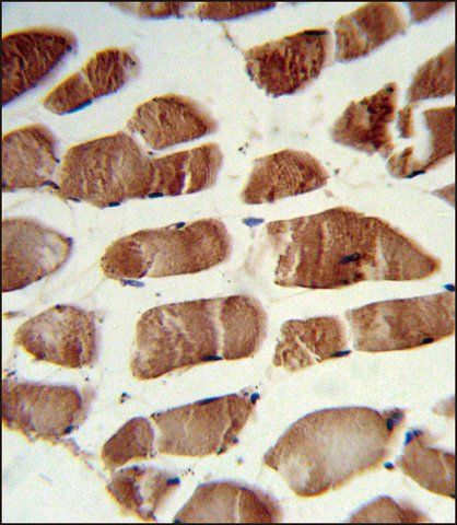 ANTI-CSRP2BP (CENTER) antibody produced in rabbit