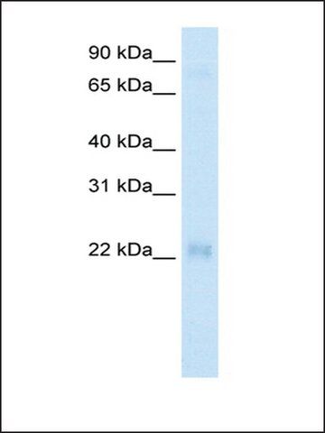 Anti-CSRP3 (AB1) antibody produced in rabbit