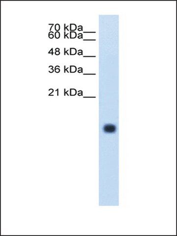 Anti-CST4 antibody produced in rabbit