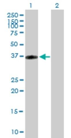 Anti-CRHR2 antibody produced in mouse