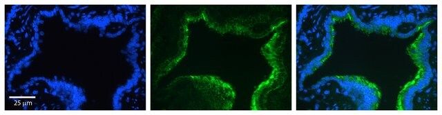 Anti-CTTN antibody produced in rabbit