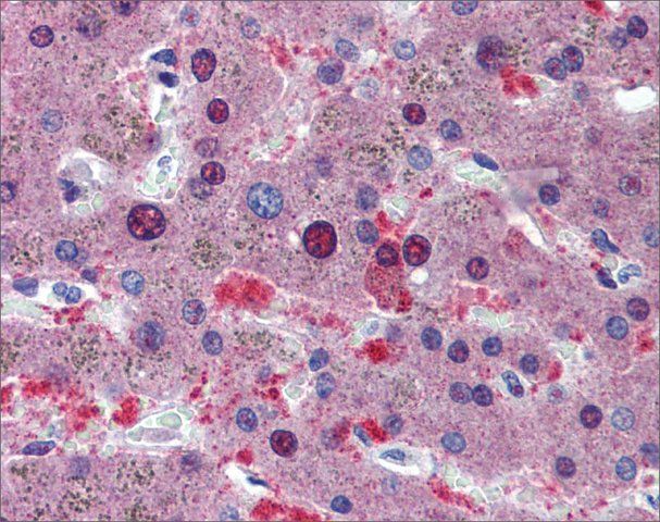 Anti-CUGBP1, (N-terminal) antibody produced in rabbit