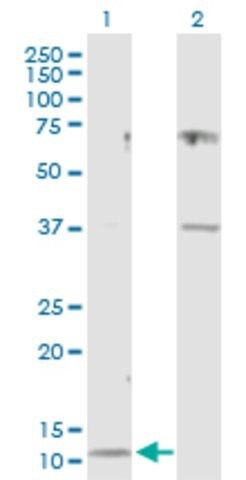 Anti-CST3 antibody produced in rabbit