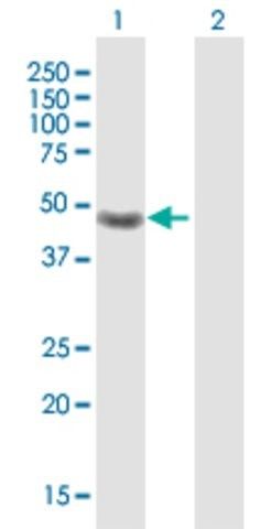 Anti-CRELD1 antibody produced in rabbit