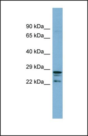 Anti-CUTC antibody produced in rabbit