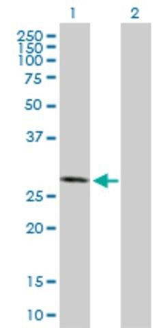 Anti-CSNK2B antibody produced in mouse