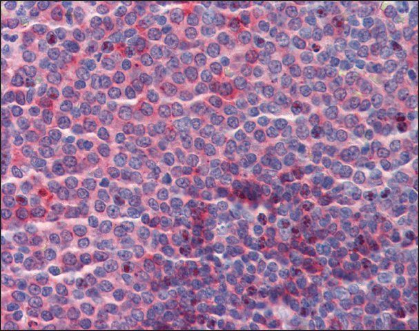 Anti-CUEDC2 antibody produced in rabbit