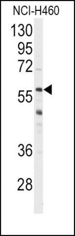Anti-CYP3A4 (center) antibody produced in rabbit