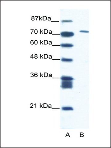 Anti-CXORF6 antibody produced in rabbit