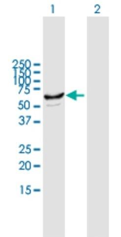 ANTI-CYP2J2 antibody produced in mouse
