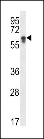 ANTI-CYP2S1(C-TERMINAL) antibody produced in rabbit