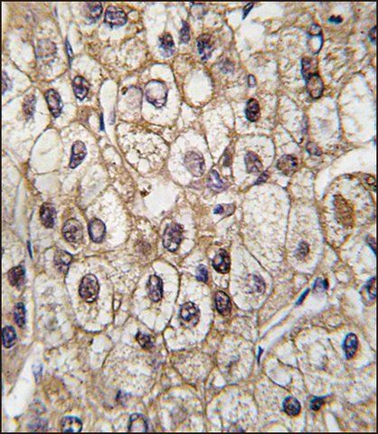 ANTI-CYP2C9 (CENTER) antibody produced in rabbit