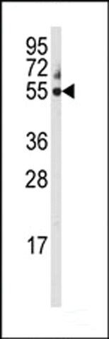 ANTI-CYP3A5(C-TERMINAL) antibody produced in rabbit