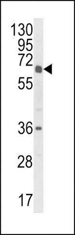 ANTI-CYP2C18(C-TERMINAL) antibody produced in rabbit
