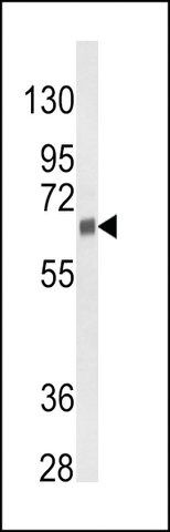 ANTI-CYP3A5 (CENTER) antibody produced in rabbit
