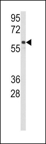 ANTI-CYP2C9 (N-TERM) antibody produced in rabbit