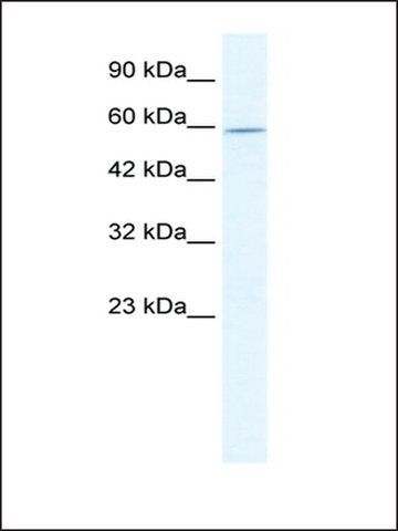 Anti-DDX47 (AB1) antibody produced in rabbit