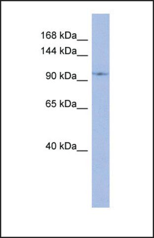 Anti-DDX26B, (N-terminal) antibody produced in rabbit