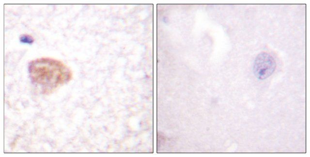 Anti-DDX3 antibody produced in rabbit