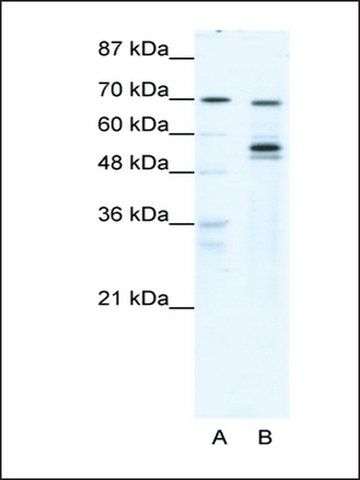Anti-DDX55 (AB1) antibody produced in rabbit
