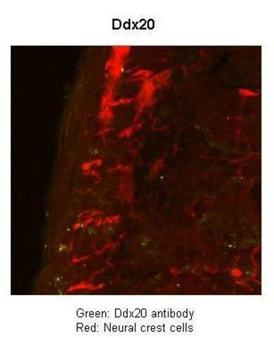 Anti-DDX20, (N-terminal) antibody produced in rabbit