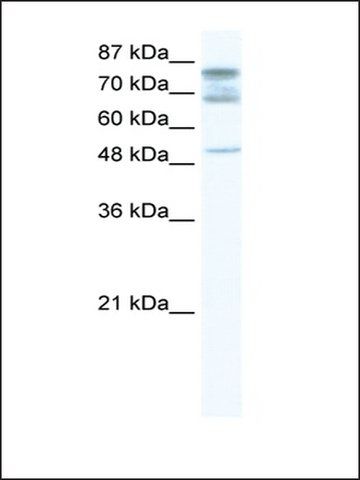 Anti-DDX46 antibody produced in rabbit