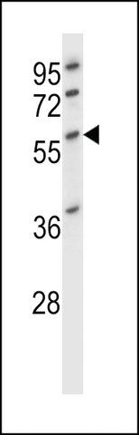 ANTI-DESMIN(C-TERMINAL) antibody produced in rabbit