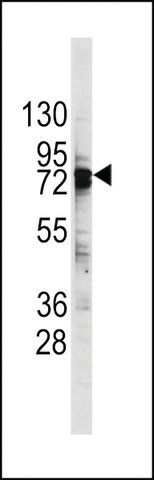 ANTI-DDX3(C-TERMINAL) antibody produced in rabbit
