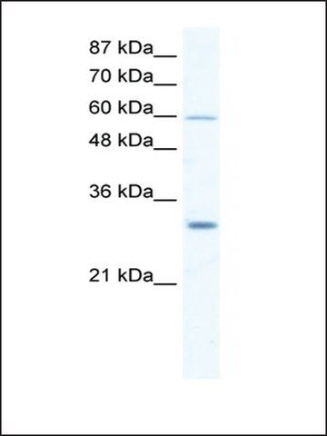 Anti-DDX31 antibody produced in rabbit