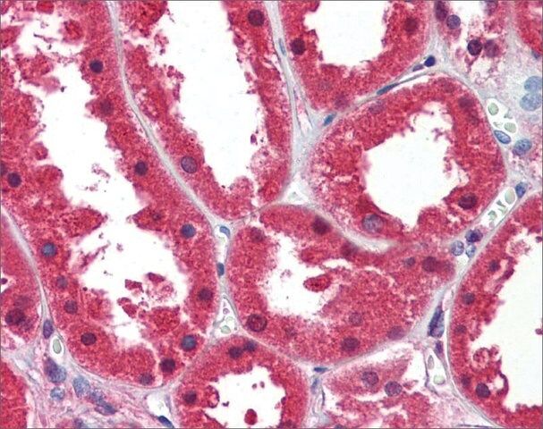 Anti-DDAH1 antibody produced in rabbit