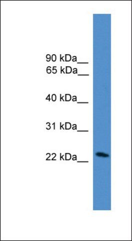 Anti-DGAT2L7 antibody produced in rabbit