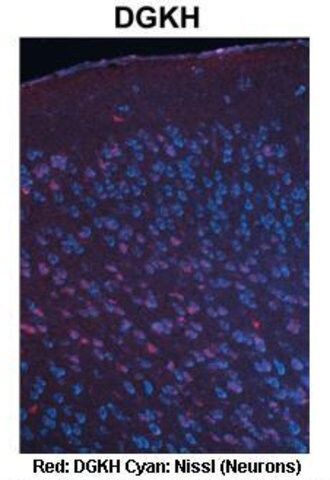 Anti-DGKH (ab1) antibody produced in rabbit