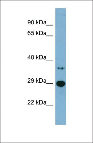 Anti-BDH2 antibody produced in rabbit
