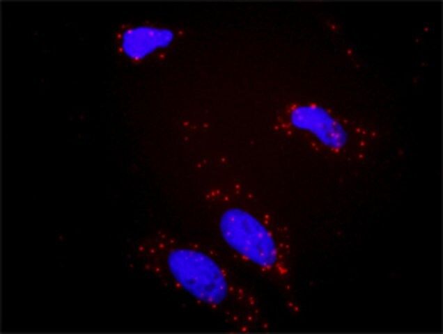 Anti-BCR antibody produced in rabbit