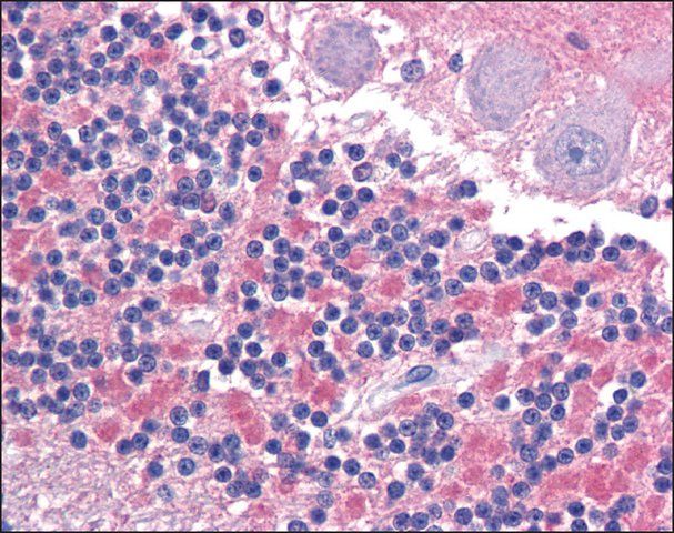 Anti-CADM2 antibody produced in rabbit