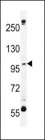 ANTI-CA026(N-TERMINAL) antibody produced in rabbit