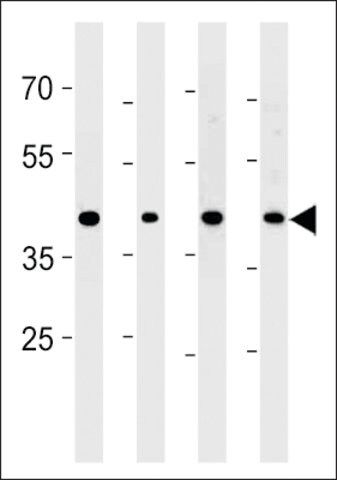ANTI-CABLES2 (CENTER) antibody produced in rabbit