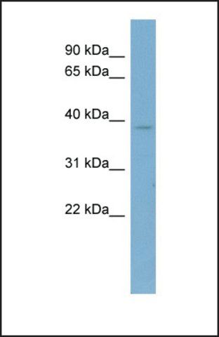 Anti-CAB39 antibody produced in rabbit