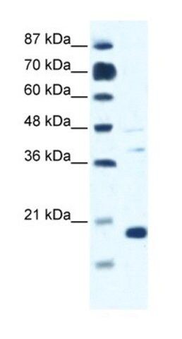 Anti-CACNG1 antibody produced in rabbit