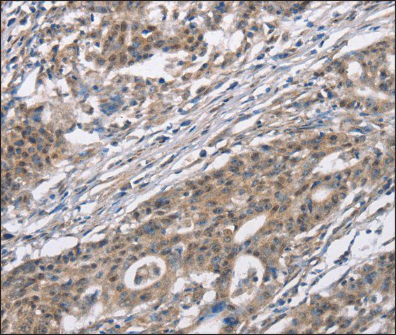 Anti-CACNA1 antibody produced in rabbit