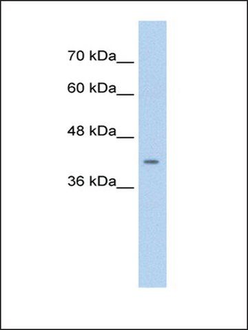 Anti-CACNB2 (AB3) antibody produced in rabbit