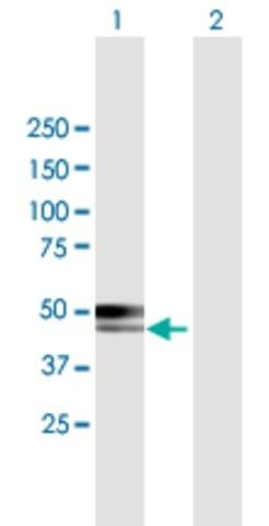 Anti-CABYR antibody produced in mouse