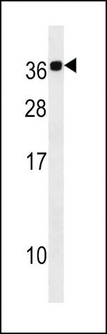 ANTI-CABP2(N-TERMINAL) antibody produced in rabbit