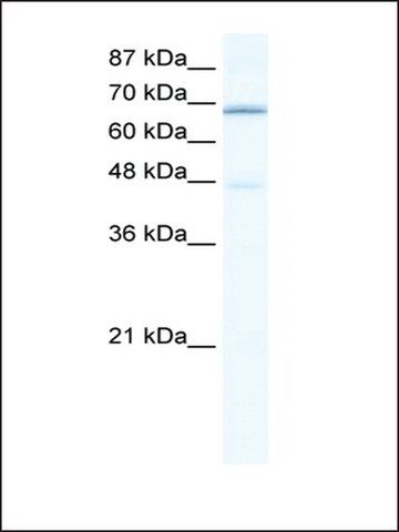 Anti-CACNB2 (ab2) antibody produced in rabbit