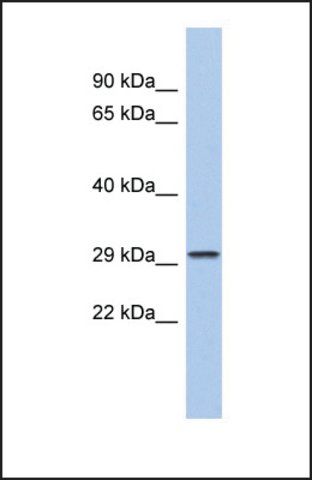 Anti-CACNG6, (N-terminal) antibody produced in rabbit