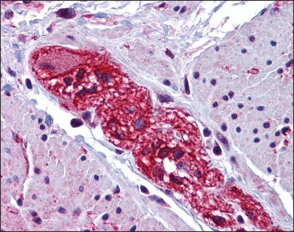 Anti-CABP7 antibody produced in rabbit