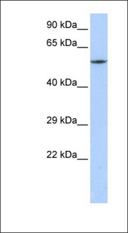 Anti-CACNB1 antibody produced in rabbit
