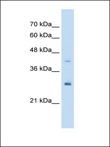 Anti-CACYBP antibody produced in rabbit