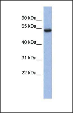 Anti-CACNB2 antibody produced in rabbit